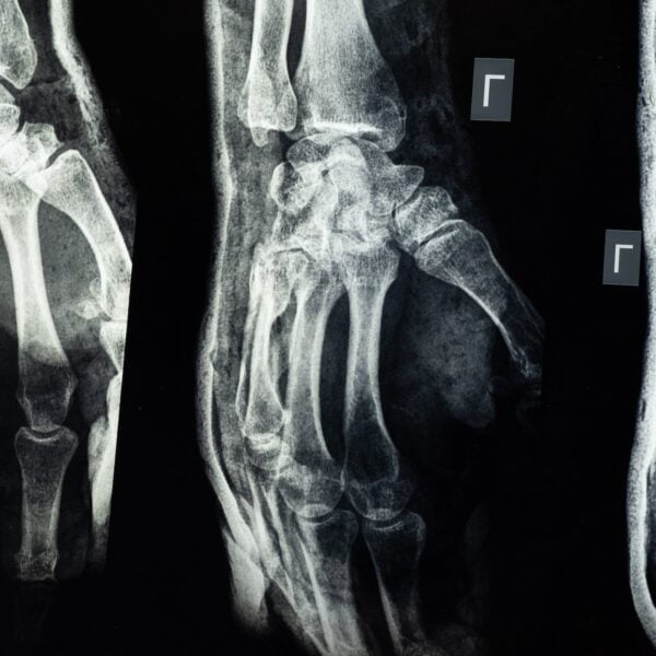 medical imaging of an injury on the hand