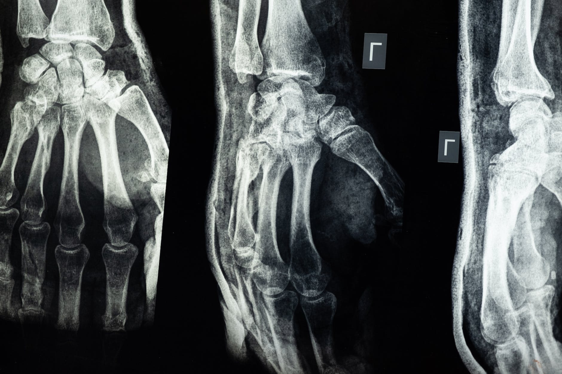 medical imaging of an injury on the hand